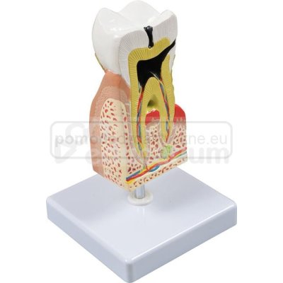 Model przekroju zęba trzonowego - budowa i trzy stany chorobowe